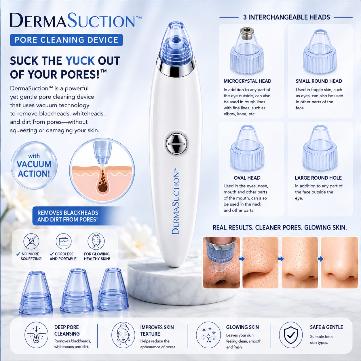5-in-1 Blackhead Remover Vacuum